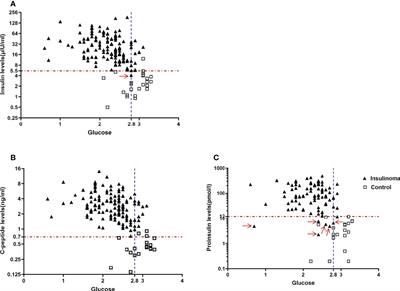 The optimal diagnostic criteria of endogenous hyperinsulinemic hypoglycemia based on a large cohort of Chinese patients